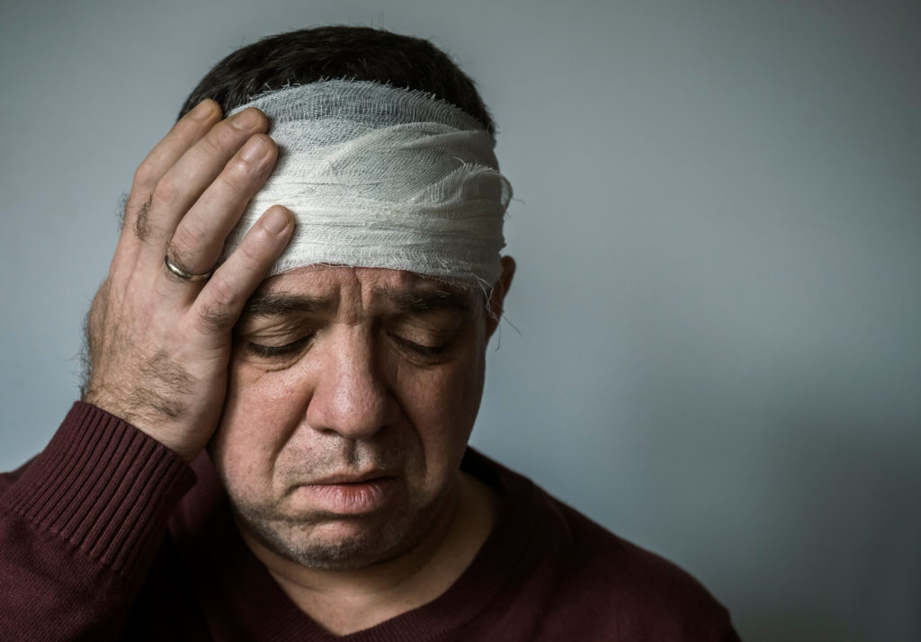 What Are Common Types of Brain Injuries?