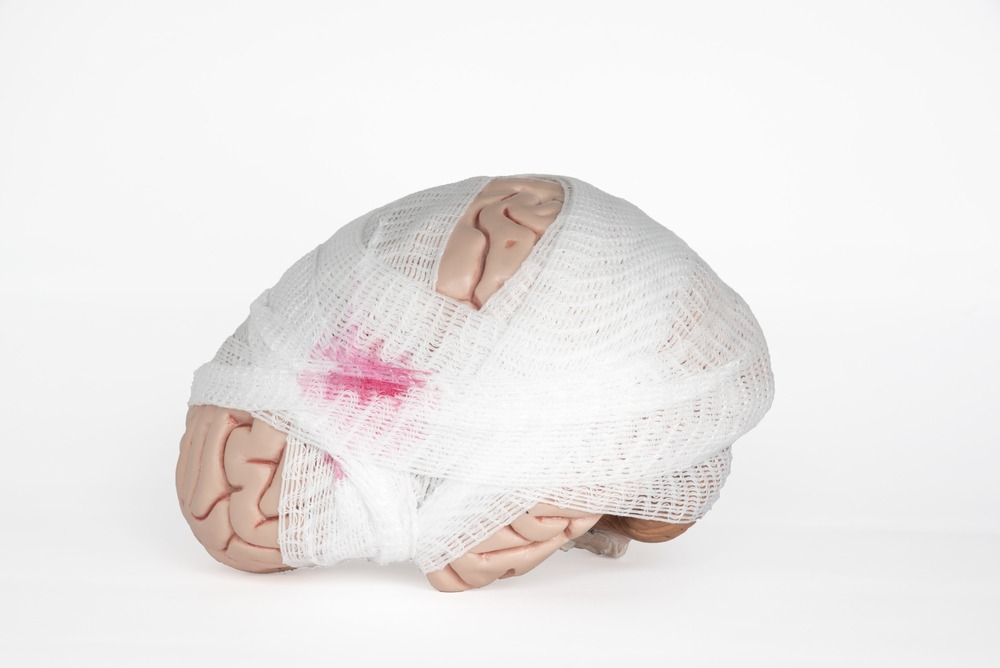 How Can an Attorney Help With My Traumatic Brain Injury Claim?