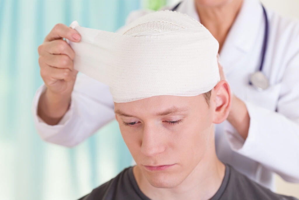 What Is the Statute of Limitations for TBI in Florida?
