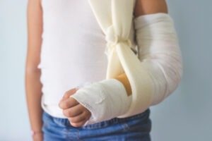 A child with a broken arm needs a North Fort Myers child injury lawyer.