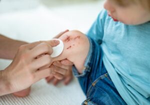 Child with a scraped knee who may have been injured at daycare