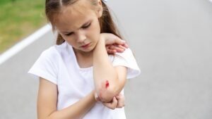 Child with a wound on her elbow, with their parent nearby, wondering what the most common daycare accidents are.